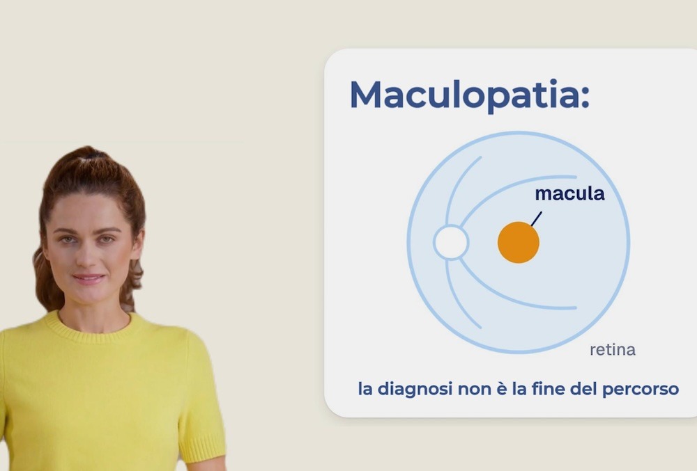 Schema della retina con la macula evidenziata: maculopatia, la diagnosi non è la fine del percorso